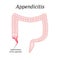 Appendicitis. Inflammation of the appendix. Colon. The illustration on background