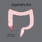 Appendicitis. Inflammation of the appendix. Colon. The illustration on a gray background