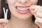 Applying orthodoentic wax on the dental braces. Brackets on the teeth after whitening. Self-ligating brackets with metal ties and