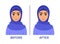 Arab Woman in Hijab with Pimples on Face. Problem Skin of a Muslim Girl. Acne treatment. Before After. Healthy Hygiene. Flat