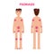 Areas of the body Psoriasis. Man nude character.
