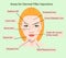 Areas for rejuvenation cosmetological injections