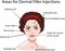 Areas for rejuvenation cosmetological injections, vector illustration for salons