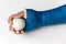 Arm with blue cast