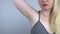 Armpit rash. Underarm skin irritation. Blonde girl shows irritation on the skin after using a razor, trimmer, deodorant or antiper