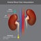 Arterial Blood Gas Interpretation. Illustration