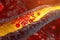 Artery clog: atherosclerosis - the cholesterol buildup in arteries, its risks, and strategies for prevention and