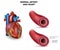 Artery and heart