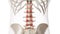 An arthritic lumbar spine