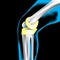 Artificial bone knee, X-Ray