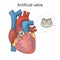 Artificial heart valve in heart medical science