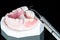 Artificial removable partial denture.