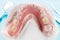 Artificial removable partial denture.