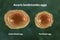 Ascaris lumbricoides eggs, illustration