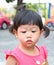 Asian baby girl eye swell