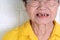 Asian Elderly woman over 70 years old be smile with a few broken teeth here have problem of ability to chew food of the elderly.