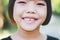 Asian kid`s decayed teeth