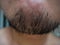 Asian male Beard hair in close up.