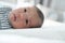 Asian Newborn baby boy lying on the bed with Common skin rash on his face at home