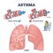 Asthma health condition compared normal and inflamed airway outline diagram