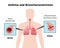 Asthma Medical Poster