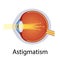 Astigmatism and Vision Disorders Illustration. Eyes Defect Concept. Detailed Anatomy Eyeball with Astigmatism Defect