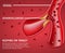 Atherosclerotic Vessels Medical Disease Banner