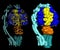 ATP synthase