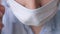 Attractive girl surgeon doctor puts surgical mask on her face. Preparation for surgery, infection protection, quarantine