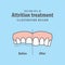 Attrition treatment comparison illustration vector on blue background. Dental concept.