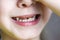 . baby girl is in the chair at the dentist. hands closes his eyes. front teeth in caries. shallow depth of cut. there is toning