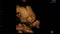 Baby Girl showing her fine Feminine Hands and Fingers. Footage of a Ultrasound 3d & 4d Gestation Scan