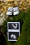 A baby`s ultrasound and shoes