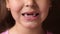 Baby teeth. Toothless smile. Cutting root tooth. The girl opens her lips and shows no front teeth. Close up