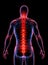 Back pain diagnosis X-Ray anatomy of the spine injury