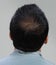 Back view of male hair head part bald