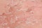 Background with the texture of irritated reddened skin with flaking scales and cracks from sunburn and allergies on the human body