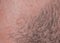 Background with the texture of irritated reddened skin of a man`s neck covered with hair and bristles