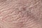 Background with the texture of pink rough unhealthy weathered human skin covered with deep wrinkles and dry scales and cracks