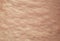 Background of the texture unhealthy irritated human skin is covered with bubbles, bumps and blisters from burns and allergies