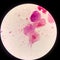 Bacteria cell Gram neagative bacilli with capsule.Sample sputum in Gram stain method