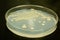 Bacterial culture on a petri plate