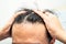 Bald at front of head and begin no loss hair glabrous of mature Asian business smart active office man