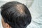 Bald in the middle head and begin no loss hair glabrous of mature Asian business smart active office man