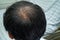 Bald in the middle head and begin no loss hair glabrous of mature Asian business smart active office man