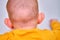 Bald spot on the back of the infant baby head. Rubbed hair of the toddler child