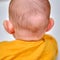 Bald spot on the back of the infant baby head. Rubbed hair of the toddler child