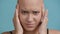 Bald Young Lady Having Headache Suffering Massaging Temples, Blue Background