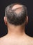 Balding Man\'s Head Portrait