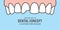 Banner Upper Chipped tooth illustration vector on blue background. Dental concept.